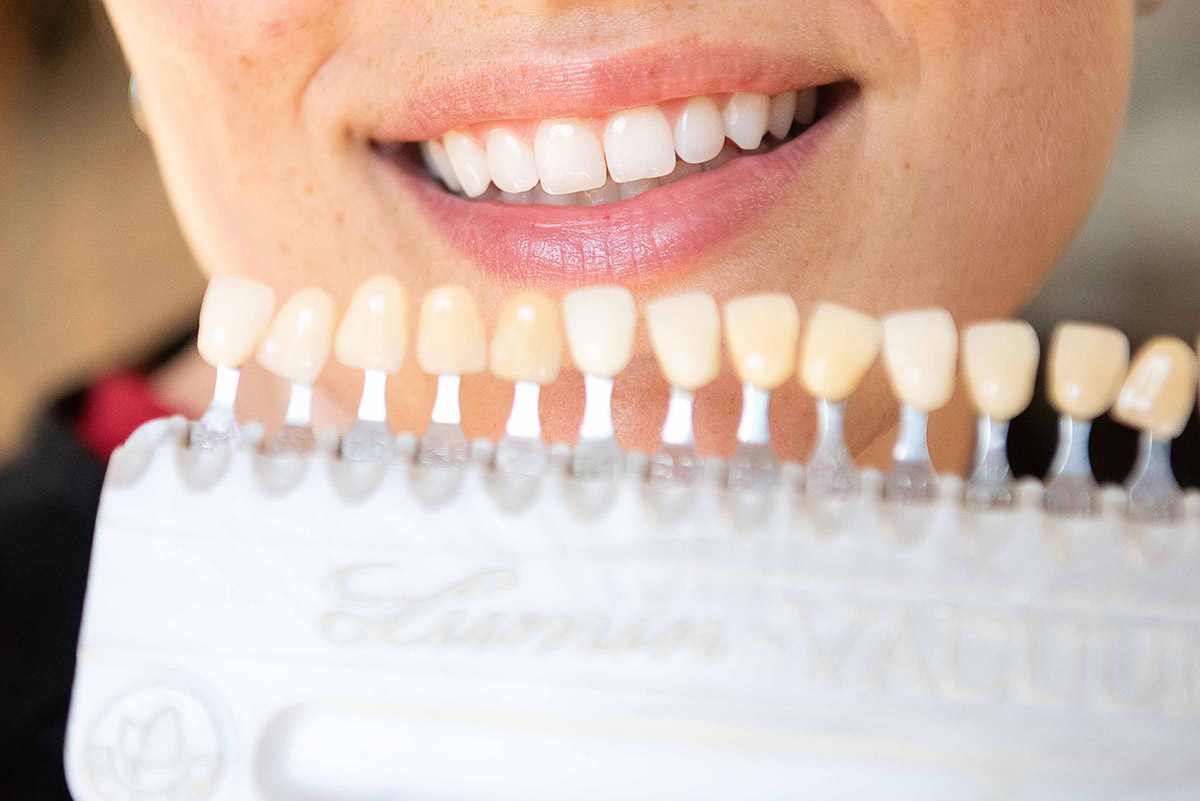 Matching a crown to a patient's tooth shade at Kvinsland Dentistry.